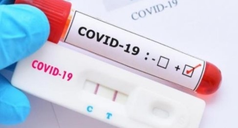 Новите случаи на Covid-19 у нас са 1862, положителните проби са близо 24 %